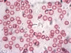 Human_red_blood_cells
