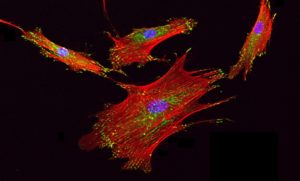Mesenchymal_stem_cells_in_culture