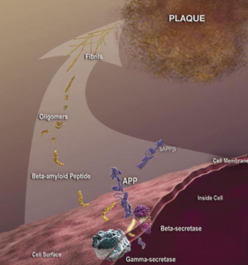 Amyloid-beta_plaque