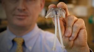 Artificial_kidney_device