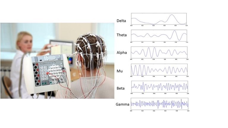 EEG Recording and Brain Waves | BioSerendipity