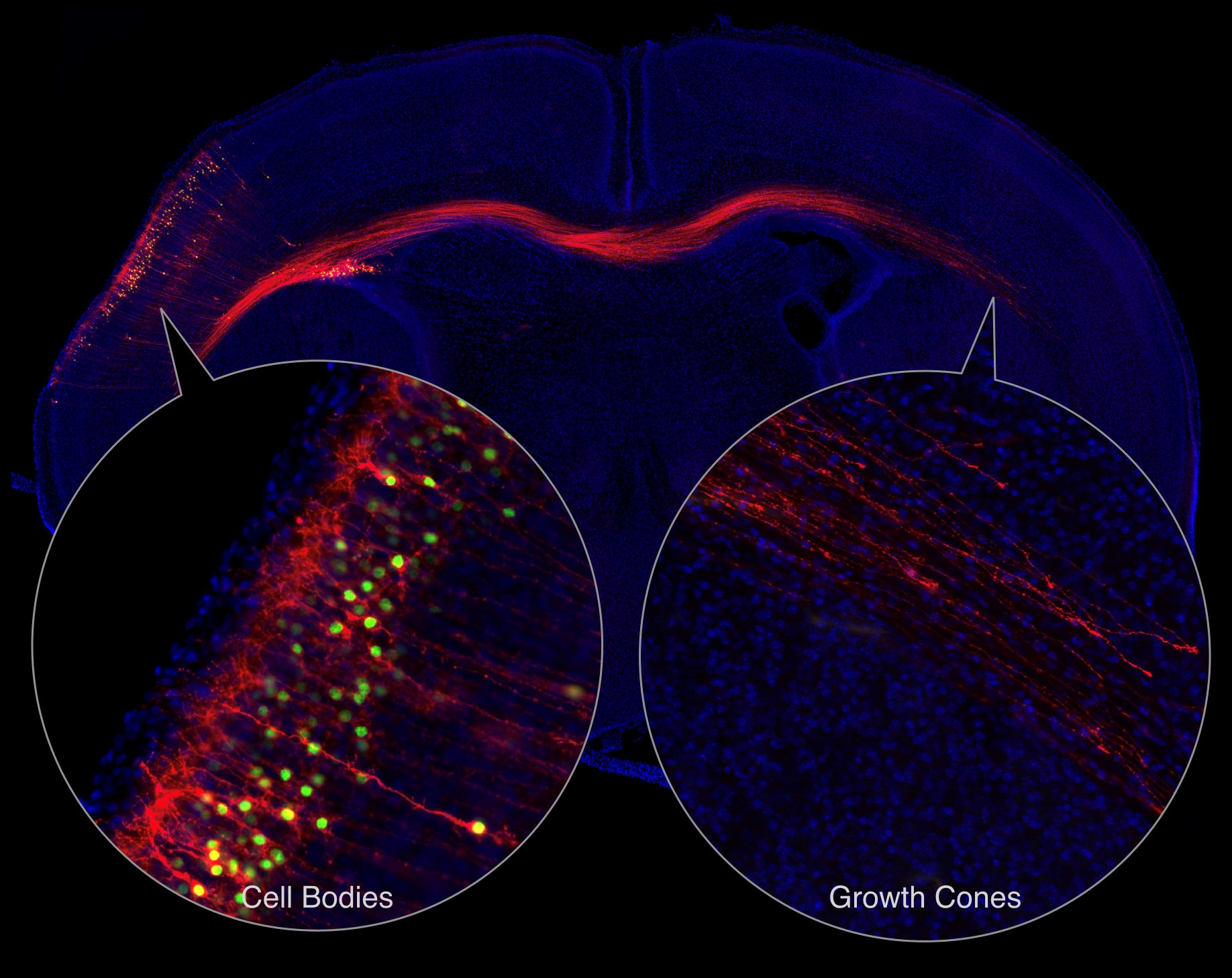 labeled_callosal_projection_neurons