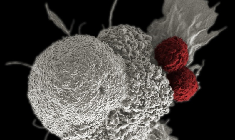 cancer-cell-and-t-cells